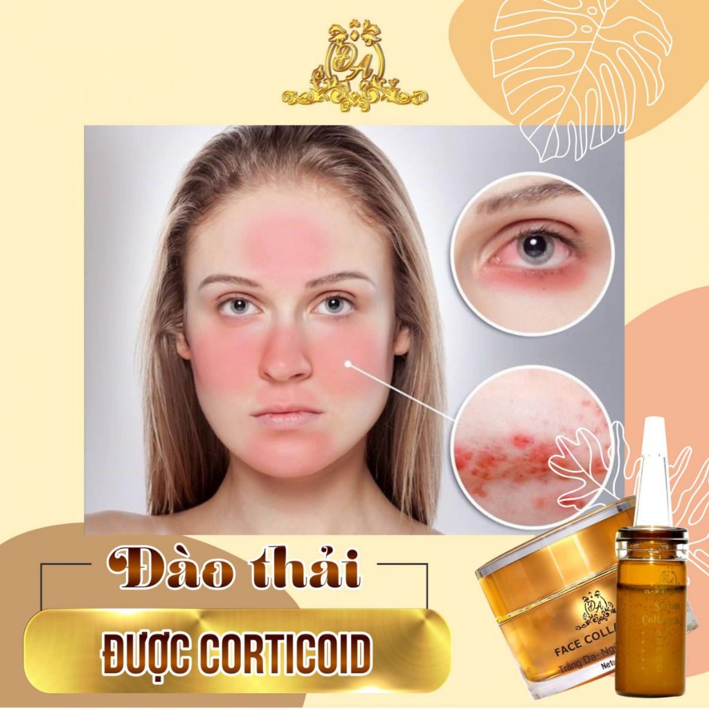 Kem Face Collagen X3 Trắng Da Ngừa Nám Mụn Se Khít Lỗ Chân Lông