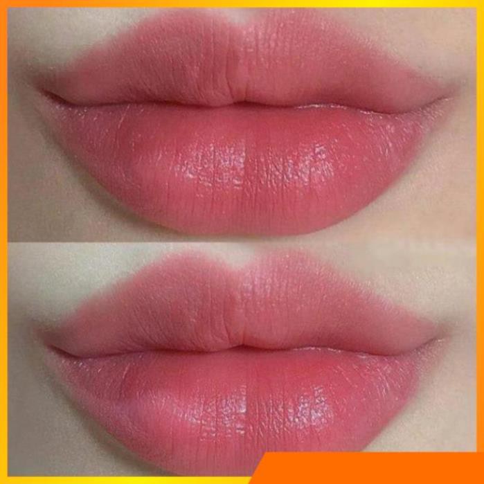 SON Ủ MÔI SHI - MỀN MÔI -DƯỠNG MÔI - HỒNG MÔI - TRỊ THÂM MÔI V V V . | BigBuy360 - bigbuy360.vn