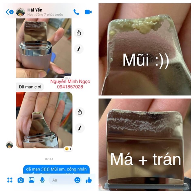 Máy làm sạch bã nhờn, lấy da chết, đẩy dưỡng Yaman