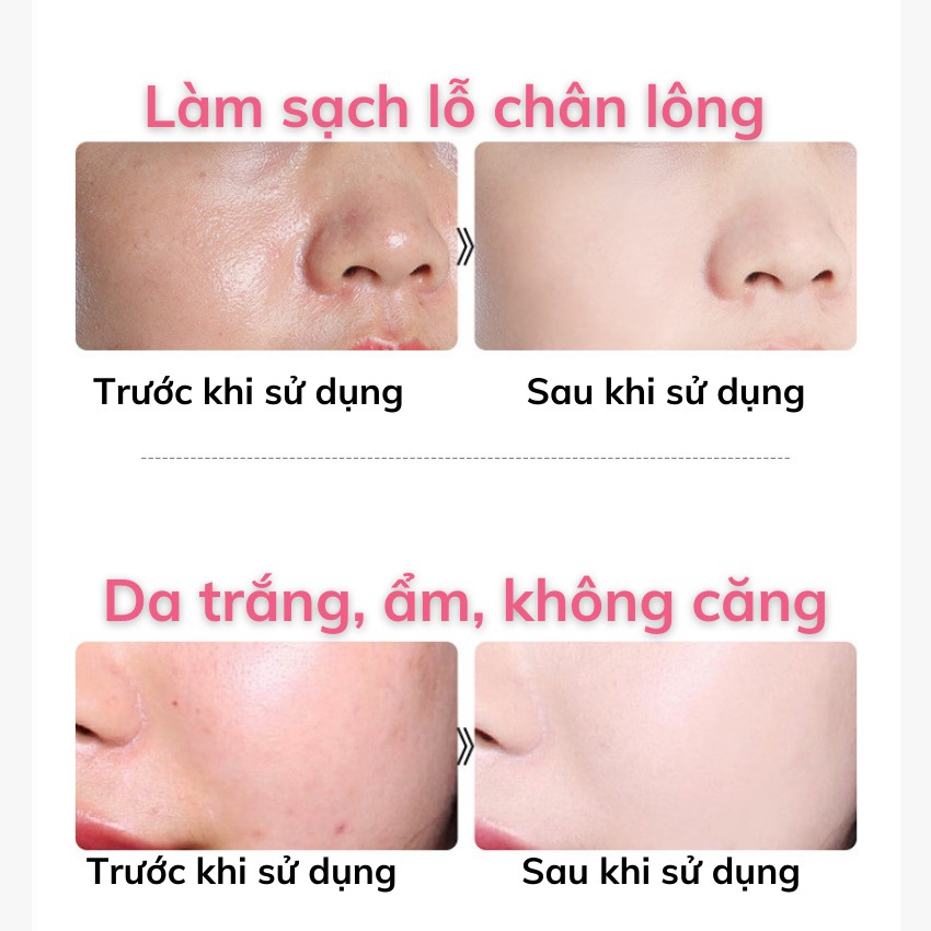 Sữa Rửa Mặt Ngừa Mụn Trắng Da KanJN 100g Sạch Dầu Ngăn Ngừa Mụn KA043 pergolden | BigBuy360 - bigbuy360.vn