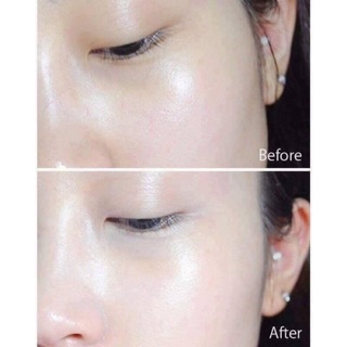 Serum Blance Vitamin C