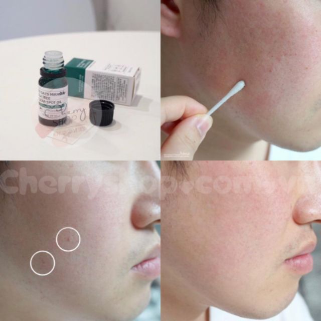 💥🍒Tinh Dầu Tràm Trà "Thần Kỳ" Some By Mi 30 Days Miracle Tea tree Clear spot oil | BigBuy360 - bigbuy360.vn