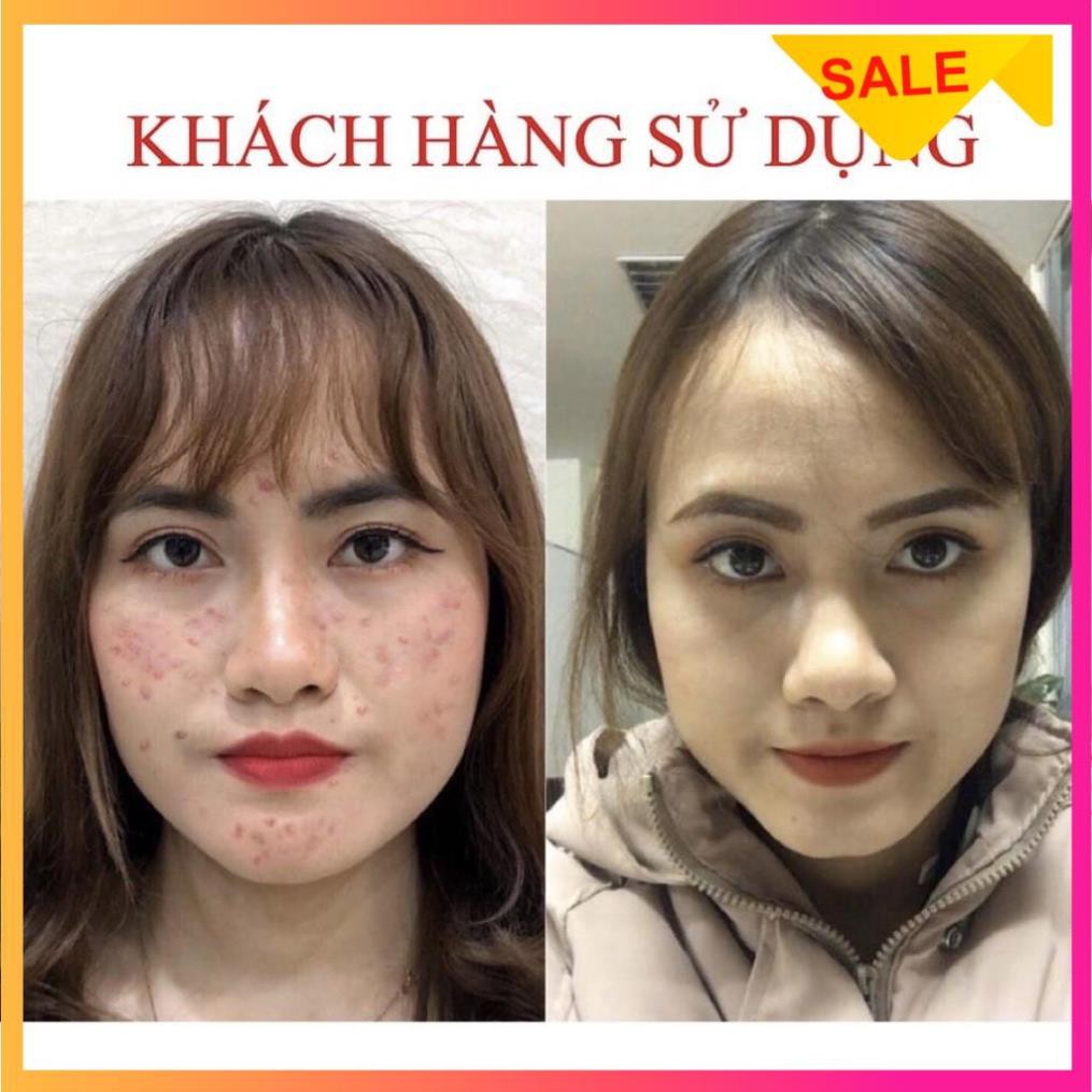 [SIÊU KHUYẾN MÃI] Serum giảm mụn thâm rỗ Seimy - Skin 7 Days | BigBuy360 - bigbuy360.vn