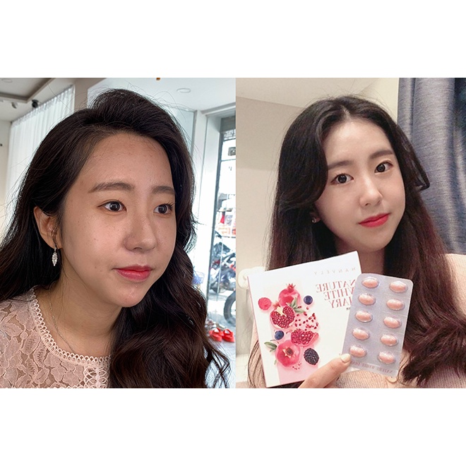 Viên Uống Trắng Da Lựu Đỏ Hanvely Nature White Diary Hàn Quốc trắng da, giảm nám, dưỡng ẩm - Hộp 30 viên