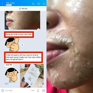 Peel da retinol vi tảo - trang nemo.