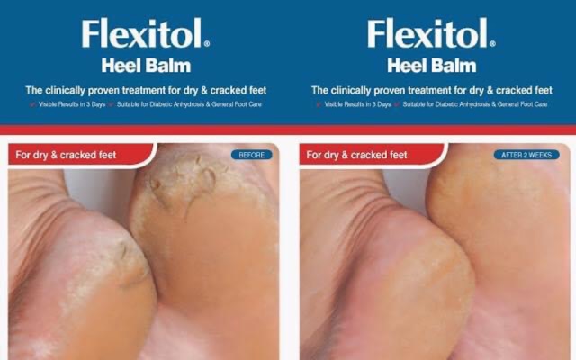 Kem nứt gót chân Heel Balm Flexitol