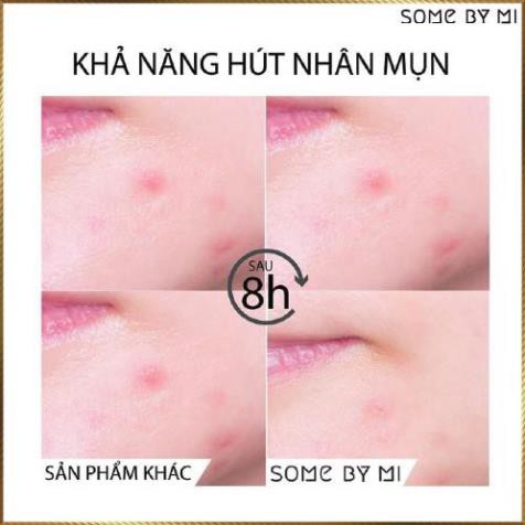 Miếng dán mụn Some By Mi Acnes Clear Patch gói 18 miếng SAC8