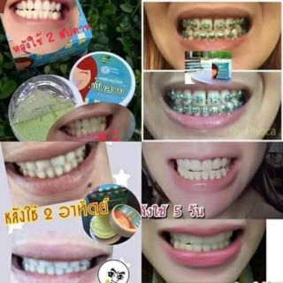 KEM ĐÁNH RĂNG CHO NGƯỜI NIỀNG RĂNG PHOCA THÁI LAN