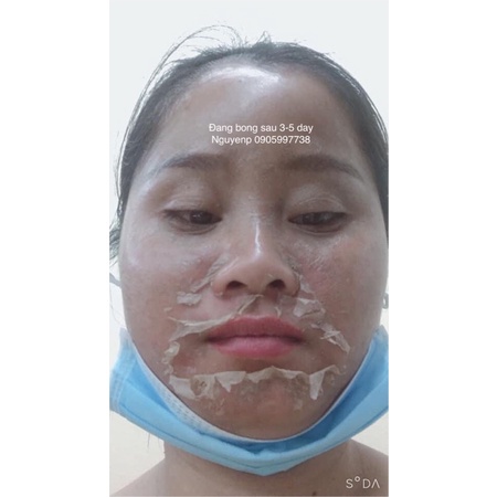 Kem dưỡng da tái tạo đông y MH ⚡ MẪU MỚI ⚡ kem dưỡng tái tảo da nhẹ nhàng đào thải các tế bào chết hiệu quả