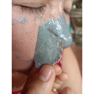 GEL HÚT MỤN THAN TRE DR.ANCE