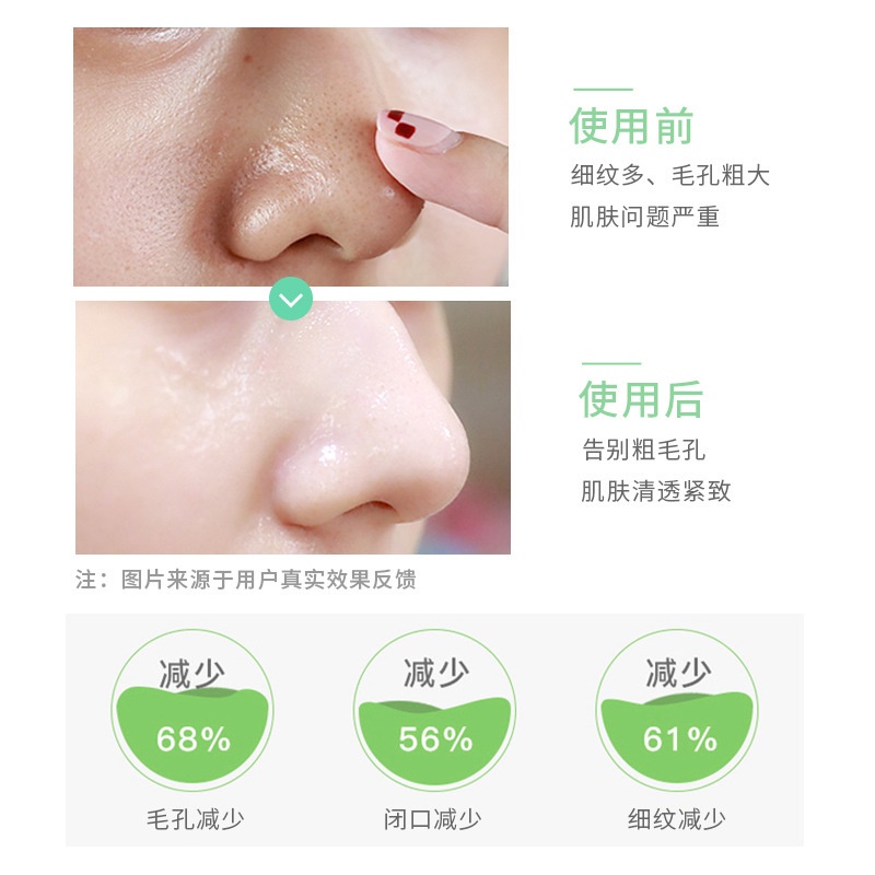 Về Young!Tinh Chất Se Khít Lỗ Chân Lông Làm Sạch Sâu Và Săn Chắc Da