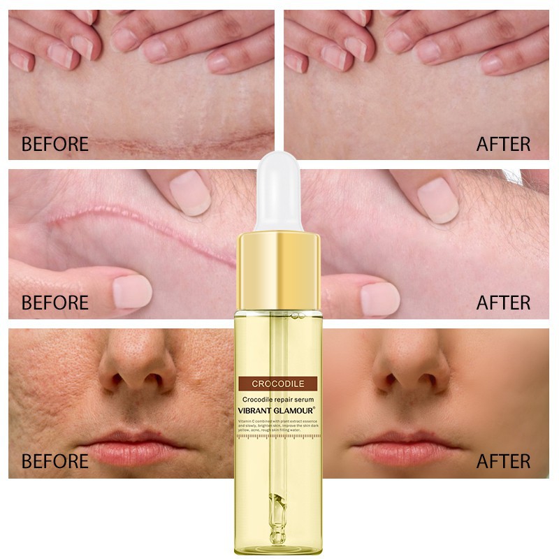 Set 3 Món Serum + Toner + Kem VIBRANT GLAMOUR Dưỡng Ẩm Làm Trắng Hỗ Trợ Mờ Thâm Giảm Sẹo Và Vết Rạn Da | BigBuy360 - bigbuy360.vn