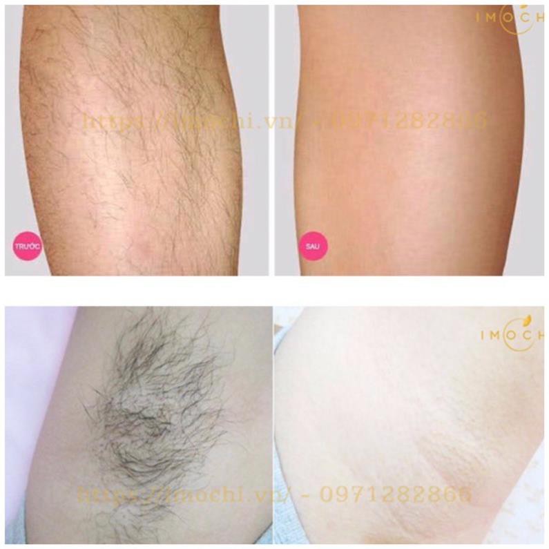 Kem TẨY LÔNG Veet Nhật Bản 150g cho da nhạy cảm . | BigBuy360 - bigbuy360.vn