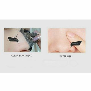 Mặt nạ lột mụn Black Head