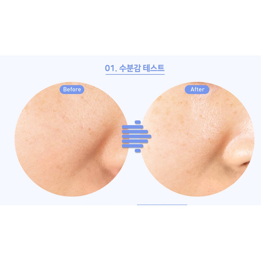 MBC Dòng dưỡng ẩm và làm dịu da NOG    SurMedic Azulene Smoothing Peptide cho da dầu