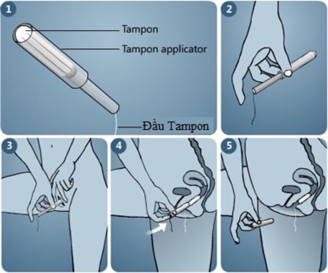 Băng vệ sinh Tampon Sofy sản xuất Nhật Bản (9 miếng)