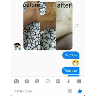 Tắm trắng cà phê