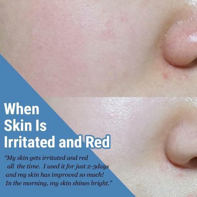  Kem Dưỡng Da Phục Hồi Klairs Midnight Blue Calming Cream | BigBuy360 - bigbuy360.vn