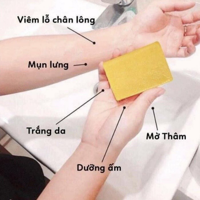 Xà bông sinh dược,xà bông tắm 100% thiên nhiên sạch da ngừa mụn hiệu quả 10 hương thơm Bánh 100G