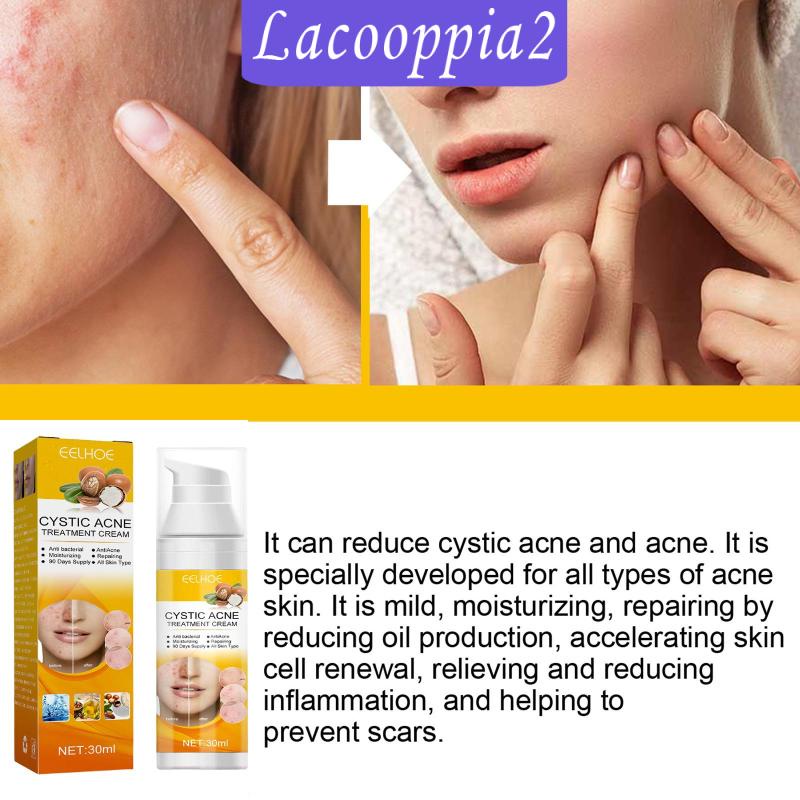 Kem Trị Mụn Lacooppia2 Làm Sáng Da Dịu Nhẹ