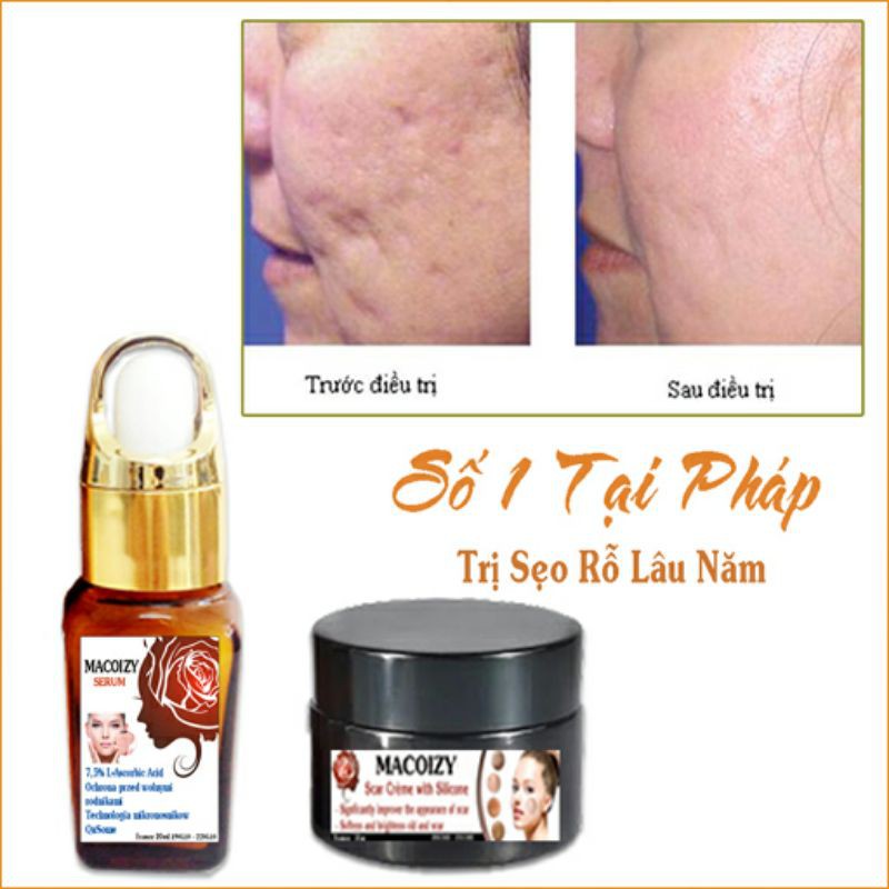 Set Serum Kem Xóa Sẹo Rỗ