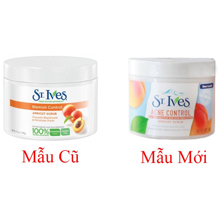 Kem Tẩy tế bào chết St Ives Acne control 283g USA | BigBuy360 - bigbuy360.vn