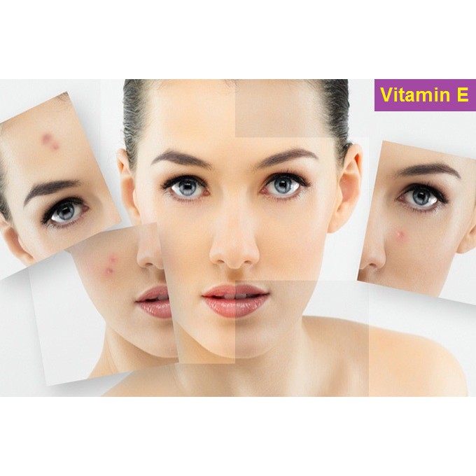 Vitamin E400 Kèm Tinh Chất Nha Đam - Giúp sáng đẹp da (Hộp 100 viên)