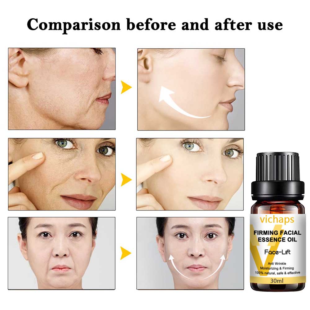 Kem Nâng Cơ Mặt Tạo Cằm Chữ V Thon Gọn Hiệu Quả