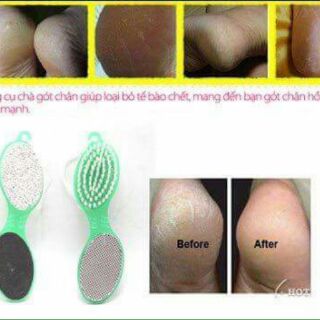 Dụng cụ chà gót chân 4.1