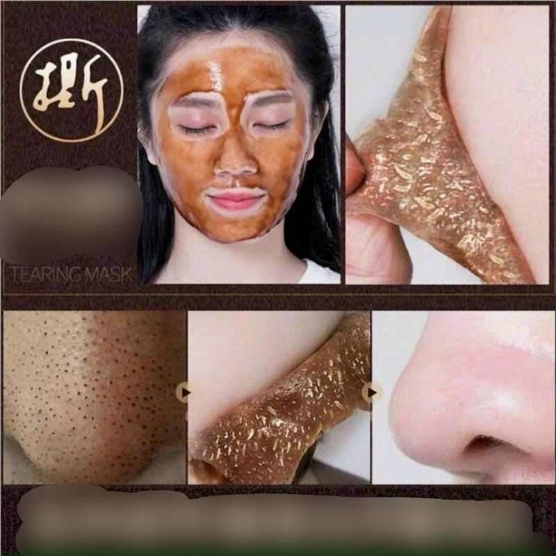 Gel Lột Mụn Nhân Sâm Skin care -Mặt Nạ Lột  Mụn Cám, Mụn Đầu Đen