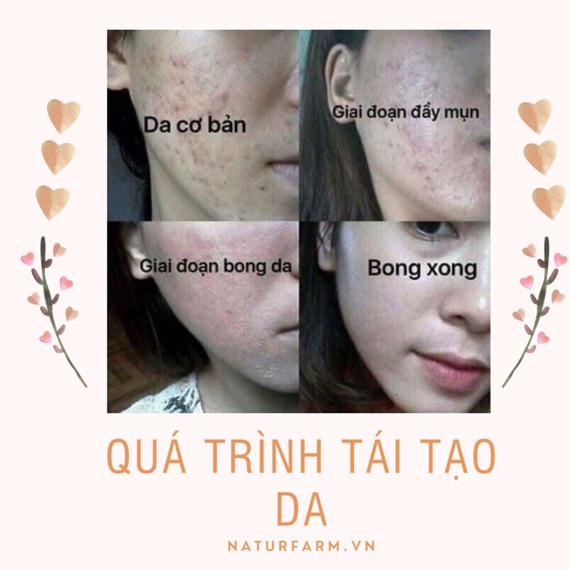 Thảo dược tái tạo da giải quyết triệt gốc mọi vấn đề về da naturfarm
