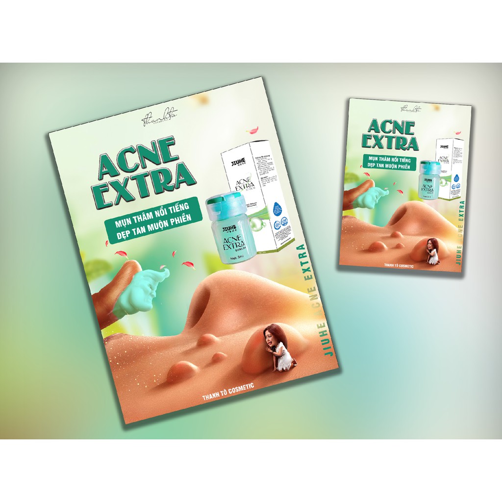 SERUM JIUHE MỤN ACNES EXTRA THANH TÔ HÀNG CHÍNH HÃNG-- SERUM DƯỠNG DA NGỪA MỤN