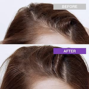 Dầu gội/Dầu xả Ryo Hàn Quốc - Chuyên gia chăm sóc tóc (Dành cho tóc gãy rụng mọi loại da đầu, chống gàu và làm sạch sâu) | BigBuy360 - bigbuy360.vn
