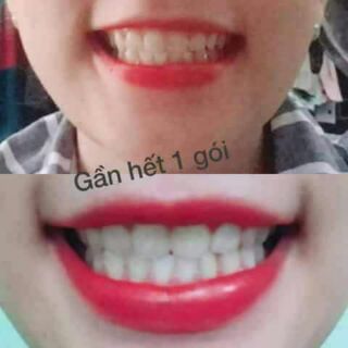 Combo 10 hộp baking soda làm trắng răng thơm miệng