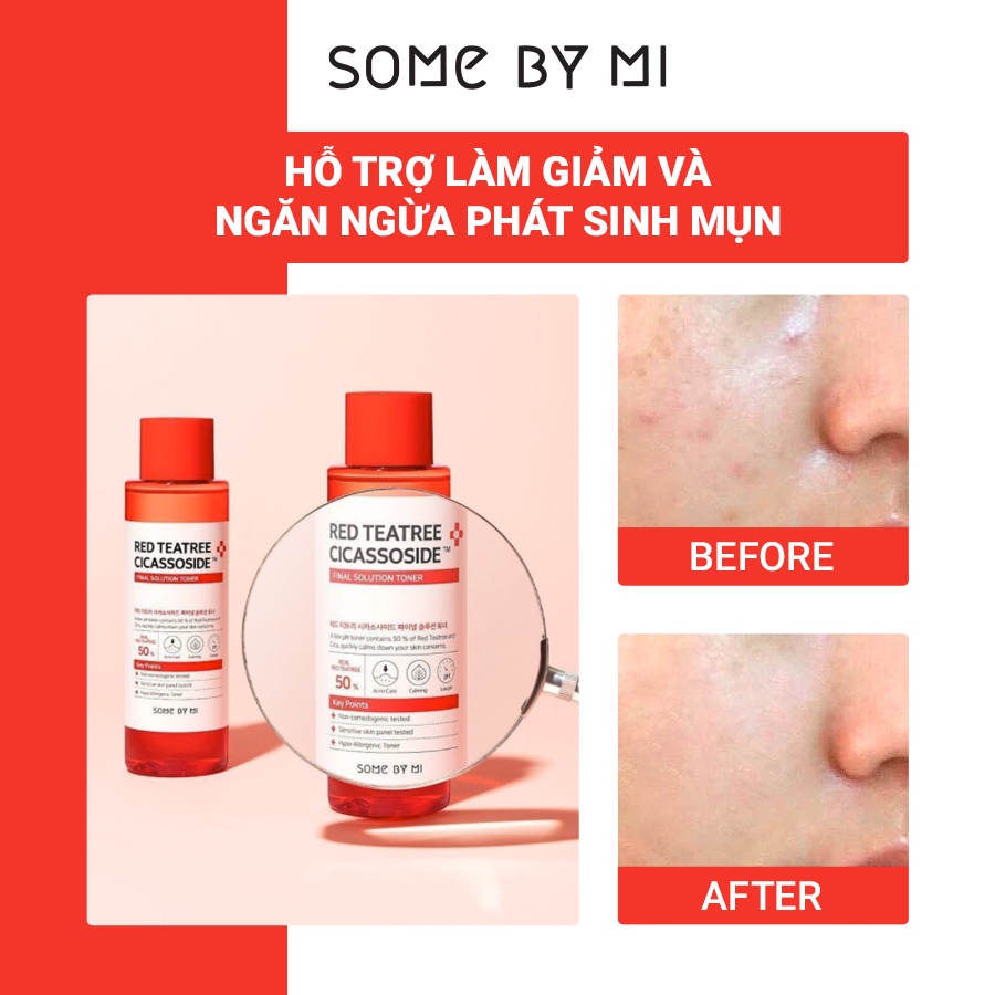 Nước Hoa Hồng Giảm Mụn Cho Da Nhạy Cảm Some ByM Red Teatree Cicassoside Final Solution 150ml