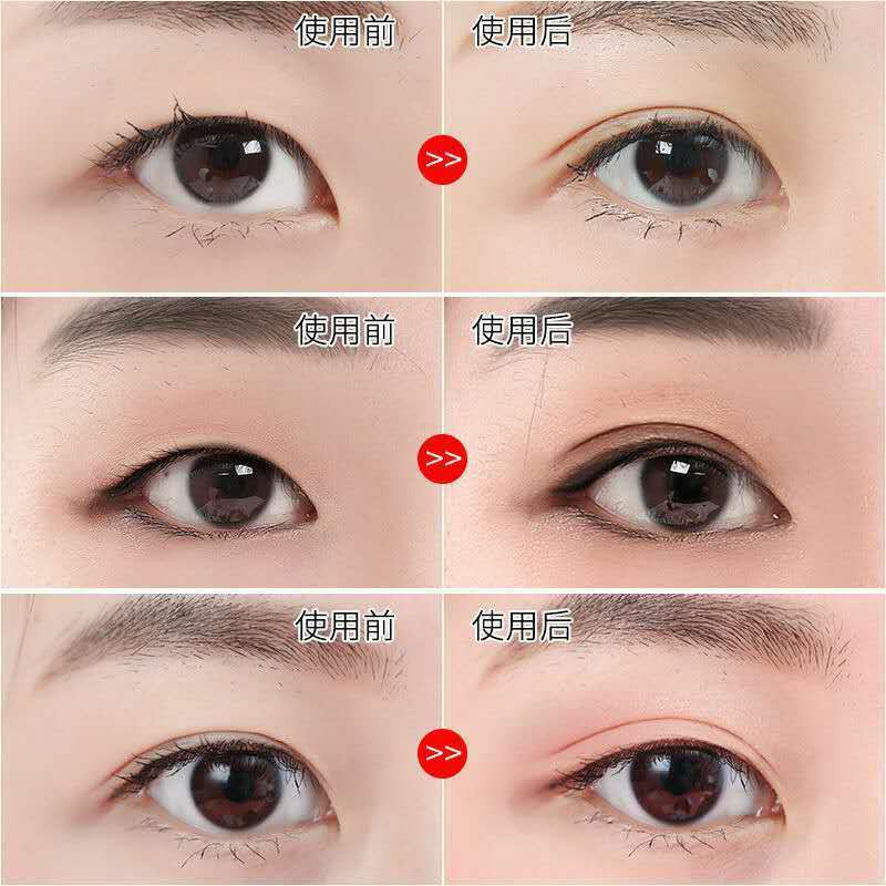 Miếng Dán Kích Hai Mí Vô Hình Chống Nước Thích Hợp Cho Người Mới Bắt Đầu