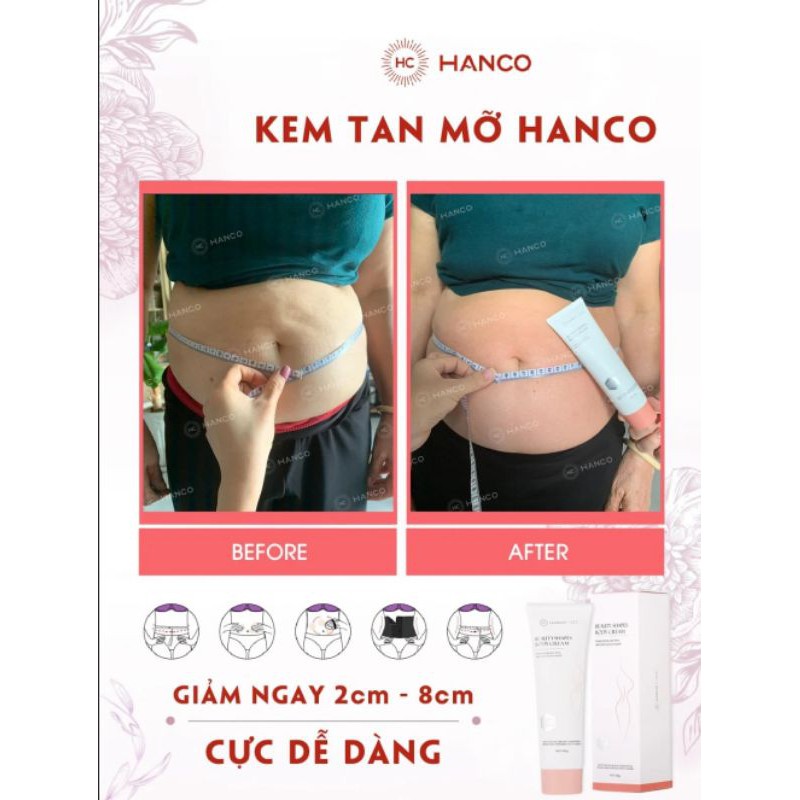 KEM TAN MỠ HANCO (TẶNG DỤNG CỤ HOẶC MÀNG QUẤN + THƯỚC DÂY) GIẢM MỠ BỤNG 2-8CM NGAY LẦN ĐẦU SỬ DỤNG