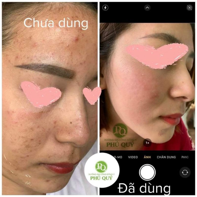 Kem tái tạo da sâm đen