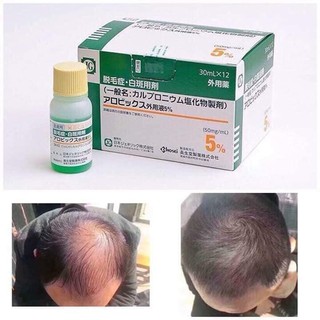 Tinh chất mọc tóc Sato Nhật Bản.