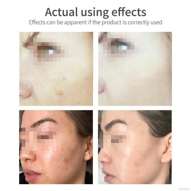 Sữa Rửa Mặt Vitamin C 100g Dưỡng Ẩm Kiềm Dầu Làm Sạch Sâu Chăm Sóc