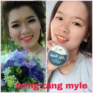 trắng răng than hoạt tính