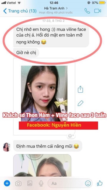 Tinh chất thon hàm má, thu xương quai hàm, hạ gò má cao | BigBuy360 - bigbuy360.vn