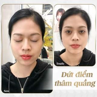 Serum Dưỡng Mắt Spotless & Wrinkle Repair giảm thâm quầng mắt bọng mắt Mediworld