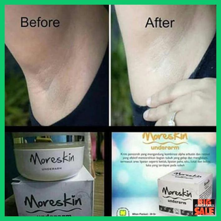 Hitumepth- MORESKIN NASA ORI -Origin. | BigBuy360 - bigbuy360.vn