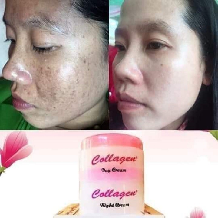 Set Dưỡng Trắng Da Collagen Plus Vit E Malaysia