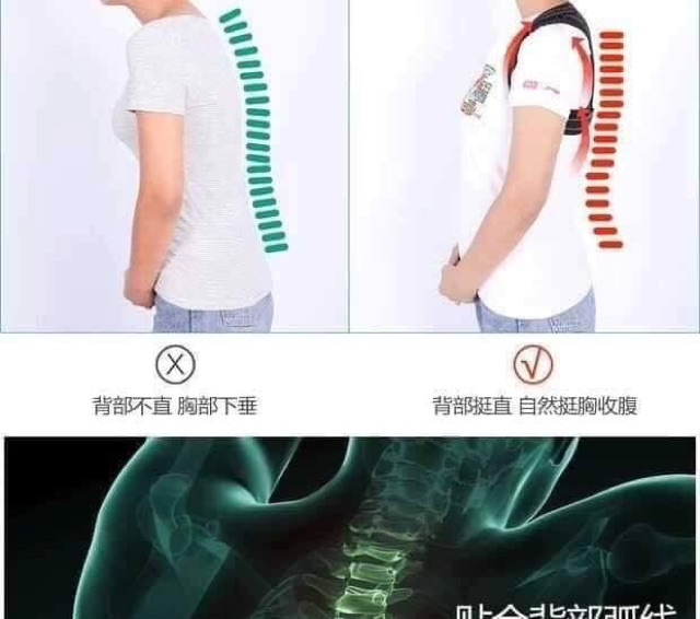 Đai chống gù lưng siêu hiệu quả - LOẠI TO ĐẮT