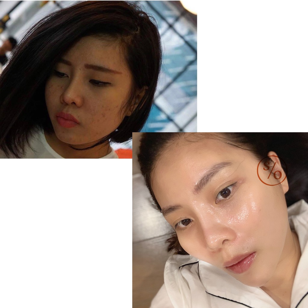 GIẢI PHÁP NGỪA MỤN NÁM SẸO RỖ TÁI TẠO LÀN DA MỚI SKIN RENEWAL SOLUTION BẰNG THẢO DƯỢC DÀNH CHO MỌI LOẠI DA | BigBuy360 - bigbuy360.vn