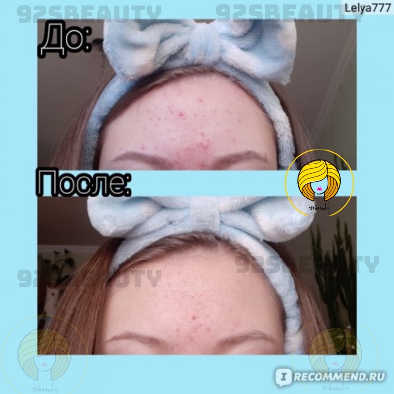 Toner Compliment No Problem làm sạch sâu, kiềm dầu, giảm viêm, giảm mụn | BigBuy360 - bigbuy360.vn