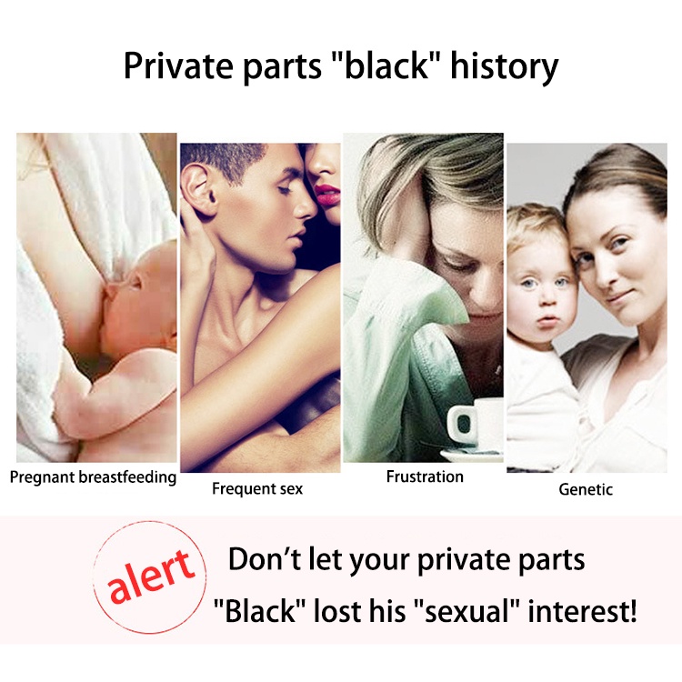 Kem chăm sóc vùng kín NM 30g tiện dụng