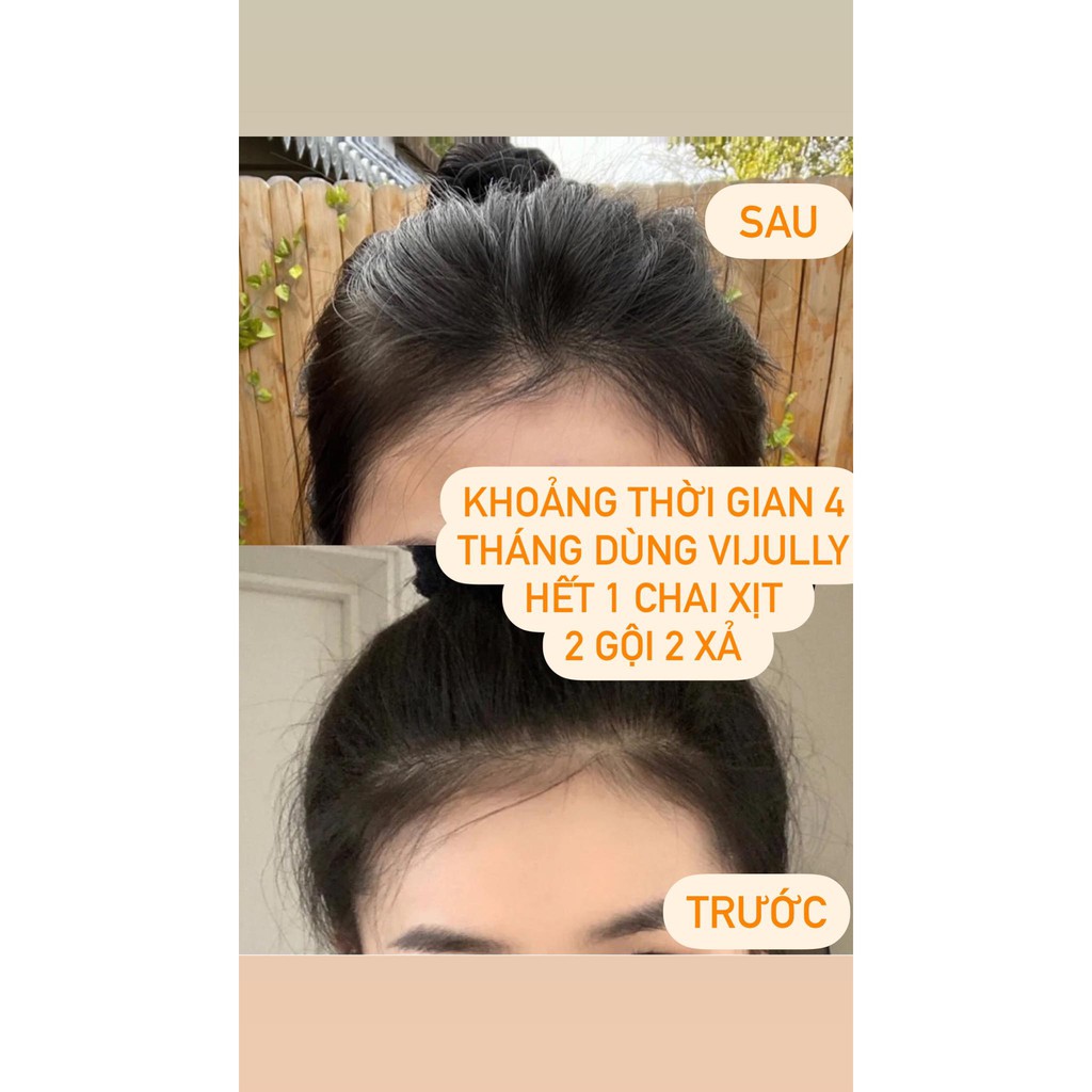 Tinh dầu dưỡng tóc bưởi Vijully kích mọc tóc, giảm rụng, làm dày tóc, hết bết, nhanh dài 100ml - TẶNG KÈM QUÀ XINH | BigBuy360 - bigbuy360.vn